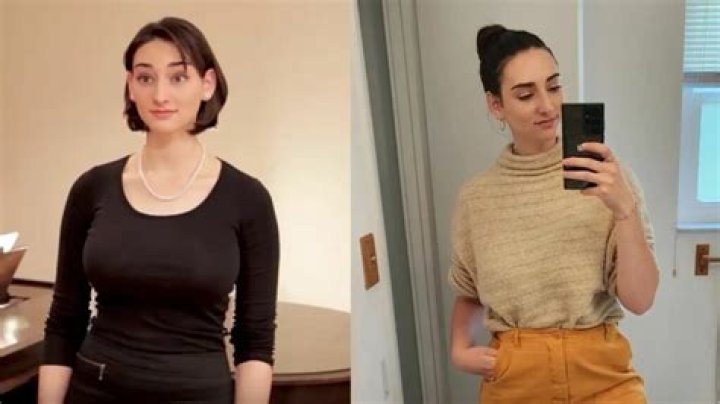 Abby Shapiro Suspected of Undergoing a Breast Reduction