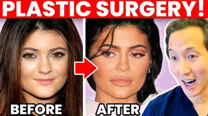 Emma Hernan’s Plastic Surgery: Her Secret to Younger Appearance? Is It Makeup?