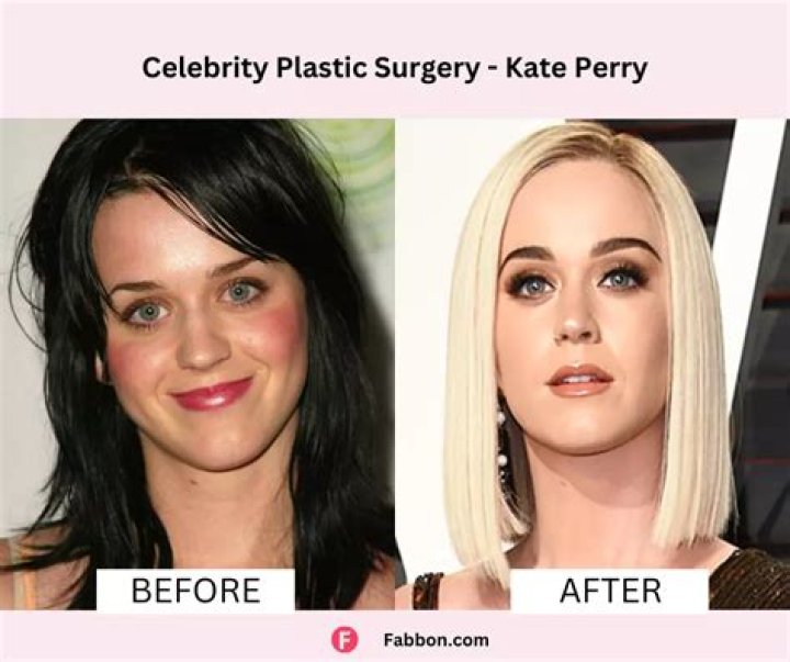 Peyton List Plastic Surgery: Before And After Photos