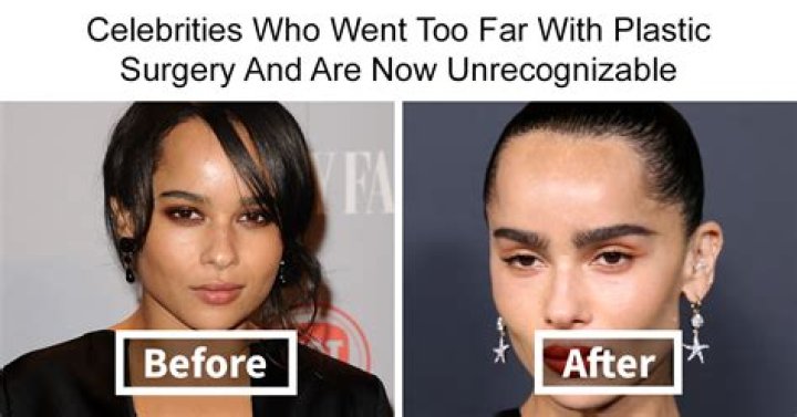 Sierra Gates Before Plastic Surgery – Is She Related To Kevin Gates?