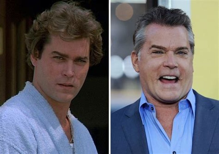 What Happened To Ray Liotta Face? Had He Done The Plastic Surgery